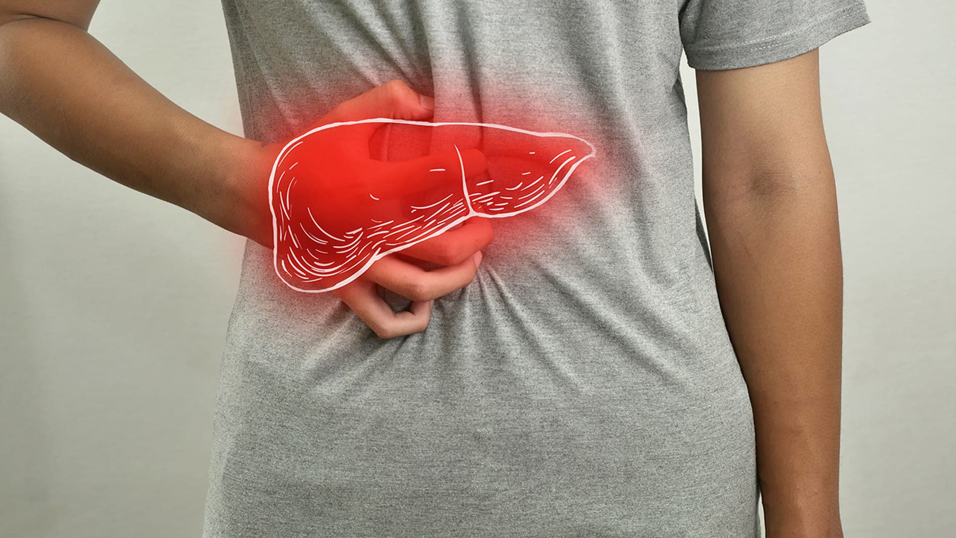 Fígado gorduroso: como identificar, tratar e prevenir a esteatose hepática