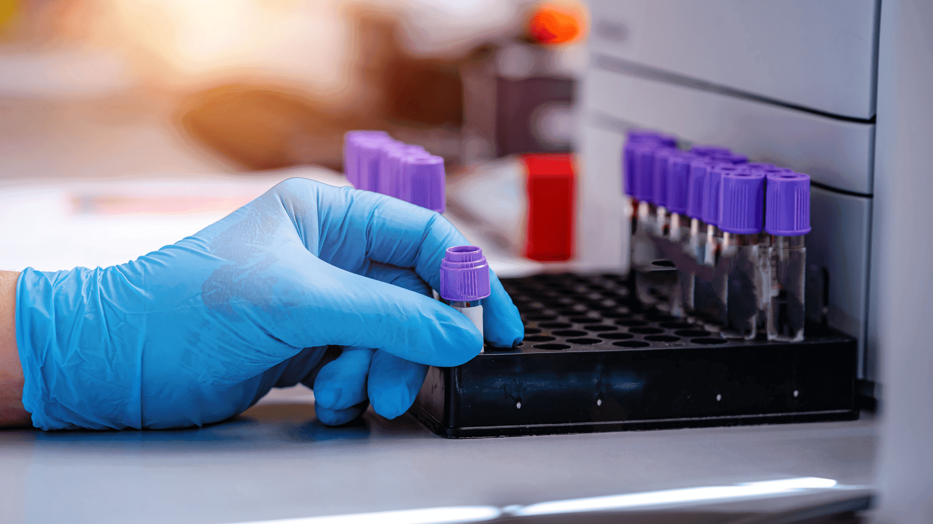 Doenças hematológicas hereditárias: conheça as principais e como diagnosticar