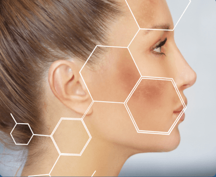Como cuidar do melasma no verão: dicas para prevenir e tratar